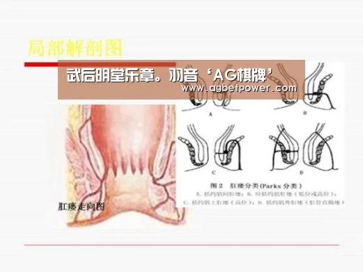 AG篮球